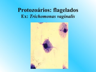 Protozoários: flagelados
 Ex: Trichomonas vaginalis
 