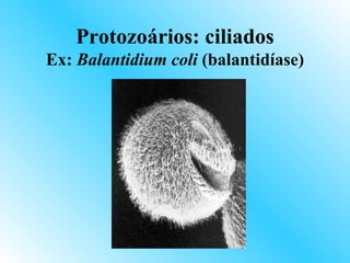 Protozoários: ciliados
Ex: Balantidium coli (balantidíase)
 