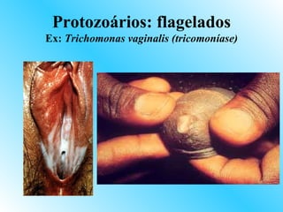 Protozoários: flagelados
Ex: Trichomonas vaginalis (tricomoníase)
 