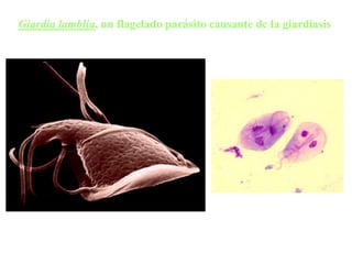 Giardia lamblia, un flagelado parásito causante de la giardiasis
 