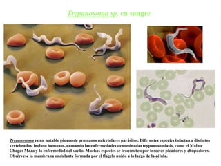 Trypanosoma sp. en sangre
Trypanosoma es un notable género de protozoos unicelulares parásitos. Diferentes especies infectan a distintos
vertebrados, incluso humanos, causando las enfermedades denominadas trypanosomiasis, como el Mal de
Chagas Maza y la enfermedad del sueño. Muchas especies se transmiten por insectos picadores y chupadores.
Obsérvese la membrana ondulante formada por el flagelo unido a lo largo de la célula.
 