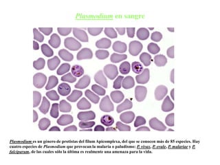 Plasmodium en sangre
Plasmodium es un género de protistas del filum Apicomplexa, del que se conocen más de 85 especies. Hay
cuatro especies de Plasmodium que provocan la malaria o paludismo: P. vivax, P. ovale, P. malariae y P.
falciparum, de las cuales sólo la última es realmente una amenaza para la vida.
 