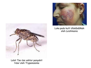 Luka pada kulit disebabkan
oleh Leishmania
Lalat Tse-tse vektor penyakit
tidur oleh Trypanosoma
 