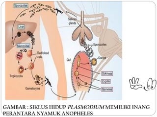 GAMBAR : SIKLUS HIDUP PLASMODIUM MEMILIKI INANG
PERANTARA NYAMUK ANOPHELES
 