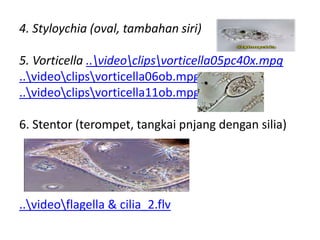 4. Styloychia (oval, tambahan siri)
5. Vorticella ..videoclipsvorticella05pc40x.mpg
..videoclipsvorticella06ob.mpg
..videoclipsvorticella11ob.mpg
6. Stentor (terompet, tangkai pnjang dengan silia)
..videoflagella & cilia_2.flv
 