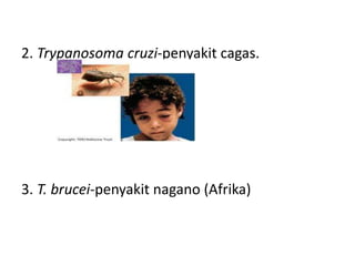 2. Trypanosoma cruzi-penyakit cagas.
3. T. brucei-penyakit nagano (Afrika)
 