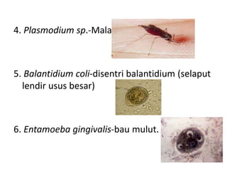 4. Plasmodium sp.-Malaria
5. Balantidium coli-disentri balantidium (selaput
lendir usus besar)
6. Entamoeba gingivalis-bau mulut.
 