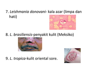 7. Leishmania donovani- kala azar (limpa dan
hati)
8. L. brasiliensis-penyakit kulit (Meksiko)
9. L. tropica-kulit oriental sore.
 