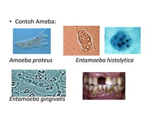 • Contoh Ameba:
Amoeba proteus Entamoeba histolytica
Entamoeba gingivalis
 