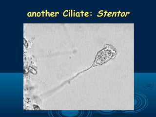 another Ciliate:another Ciliate: StentorStentor
 