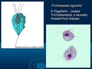 Trichomonas vaginalisTrichomonas vaginalis
A flagellate - causesA flagellate - causes
Trichomoniasis, a sexuallyTrichomoniasis, a sexually
transmitted diseasetransmitted disease
 