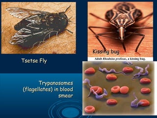 Tsetse fly
TrypanosomesTrypanosomes
(flagellates) in blood(flagellates) in blood
smearsmear
Kissing bugKissing bug
Tsetse FlyTsetse Fly
 