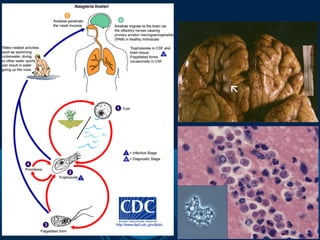 Naegleria fowleri
 