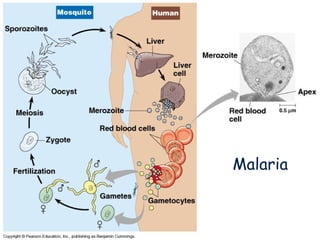 Malaria
 