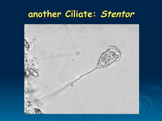 another Ciliate:
another Ciliate: Stentor
Stentor
 