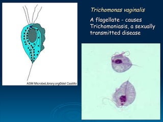 Trichomonas vaginalis
Trichomonas vaginalis
A flagellate - causes
A flagellate - causes
Trichomoniasis, a sexually
Trichomoniasis, a sexually
transmitted disease
transmitted disease
 