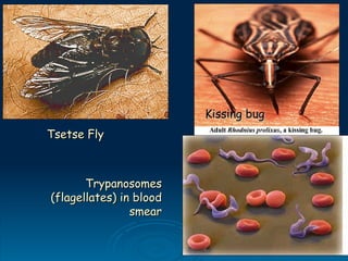 Tsetse fly
Trypanosomes
Trypanosomes
(flagellates) in blood
(flagellates) in blood
smear
smear
Kissing bug
Kissing bug
Tsetse Fly
Tsetse Fly
 