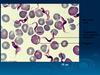 25 µm
Flagellum
Red blood
cells
Trypanosome
with undulating
membrane
 