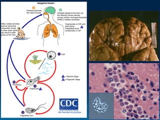 Naegleria fowleri
 
