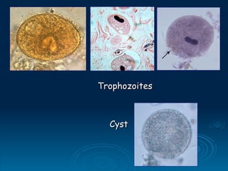 Trophozoites
Trophozoites
Cyst
Cyst
 