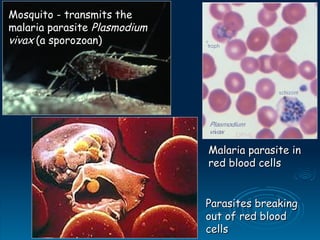 Mosquito - transmits the
Mosquito - transmits the
malaria parasite
malaria parasite Plasmodium
Plasmodium
vivax
vivax (a sporozoan)
(a sporozoan)
Malaria parasite in
Malaria parasite in
red blood cells
red blood cells
Parasites breaking
Parasites breaking
out of red blood
out of red blood
cells
cells
 