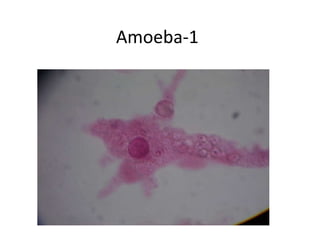 Amoeba-1 