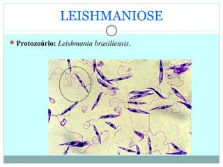 LEISHMANIOSE
Protozoário: Leishmania brasiliensis.
 