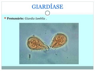 GIARDÍASE
Protozoário: Giardia lamblia .
 