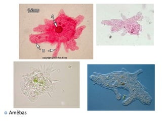 AmēbasCilvēka slimība – amebiāze!!Izraisa dizentērijas amēba!Slimība ir bīstama dzīvībai;Pirmais simptoms – caureja;Otrais simptoms – asiņaina caureja;Trešais simptoms, ja cilvēks izdzīvo -  bojātas aknas un bojātas plaušas, kā rezultātā asiņu klepus;Ceturtais simptoms, ja cilvēks vēl izdzīvo – nāve, jo smadzenes tiek bojatas.Obligāti mazgāt rokas, traukus un ēdienu!!!