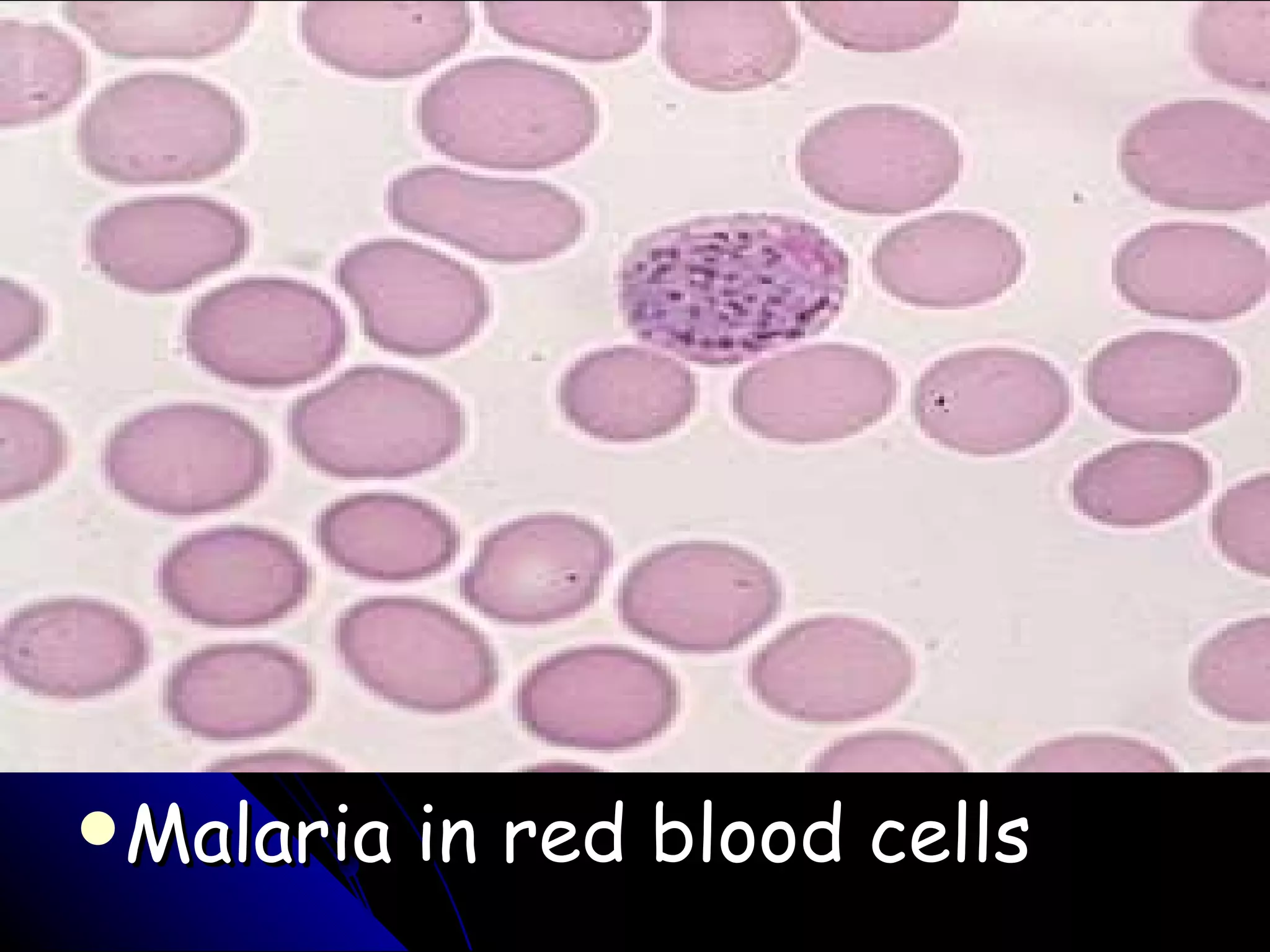 Malaria in red blood cells 
