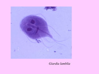 Giardia lamblia 