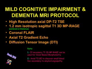 MILD COGNITIVE IMPAIRMENT &
DEMENTIA MRI PROTOCOL
• High Resolution axial DP-T2 TSE
• 1.2 mm isotropic sagittal T1 3D MP-RAGE
(centered on thalamus)
• Coronal FLAIR
• Axial T2 Gradient Echo
• Diffusion Tensor Image (DTI)
Note:
1.- If necessary T1 3D MP-RAGE can be
used for Voxel Based Morphometry
2.- Axial T2 GE to discover small blood
foci secondary to amyloid angiopathy
 