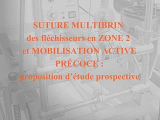 SUTURE MULTIBRIN  des fléchisseurs en ZONE 2  et MOBILISATION ACTIVE PRÉCOCE : proposition d’étude prospective 