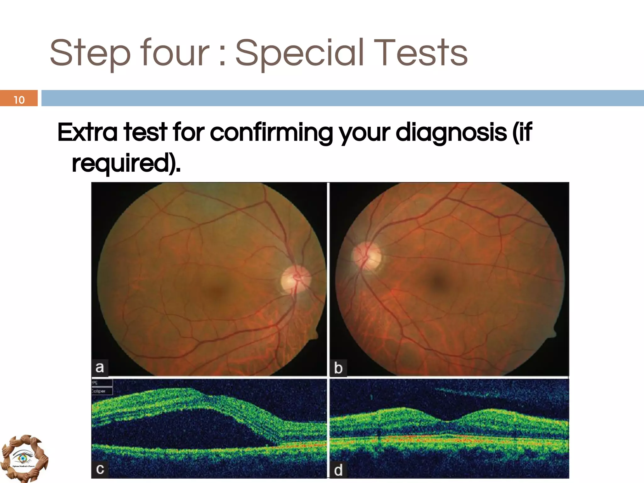 Step four : Special Tests
Extra test for confirming your diagnosis (if
required).
10
 