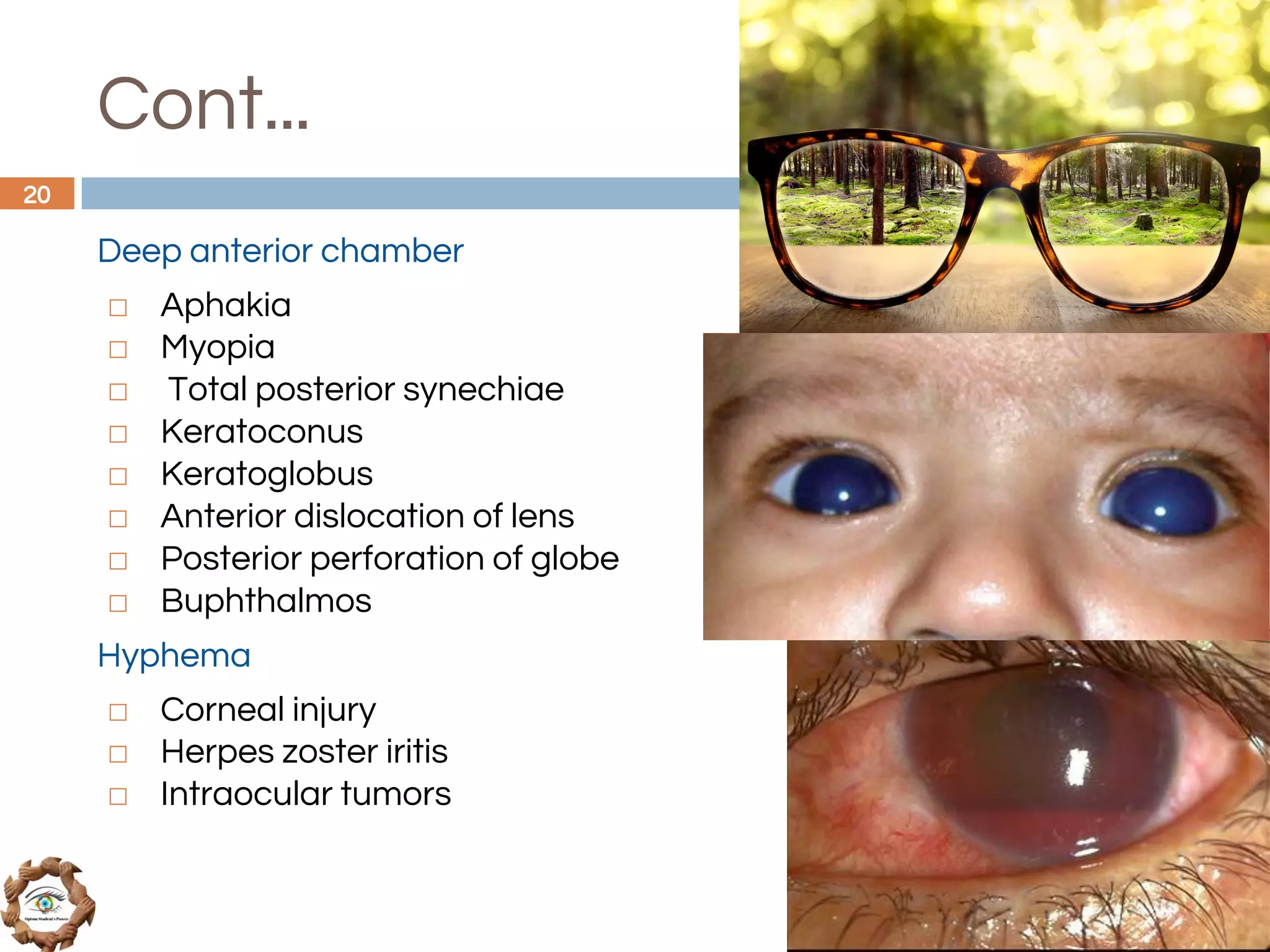 Cont...
Deep anterior chamber
◻ Aphakia
◻ Myopia
◻ Total posterior synechiae
◻ Keratoconus
◻ Keratoglobus
◻ Anterior dislocation of lens
◻ Posterior perforation of globe
◻ Buphthalmos
Hyphema
◻ Corneal injury
◻ Herpes zoster iritis
◻ Intraocular tumors
20
 