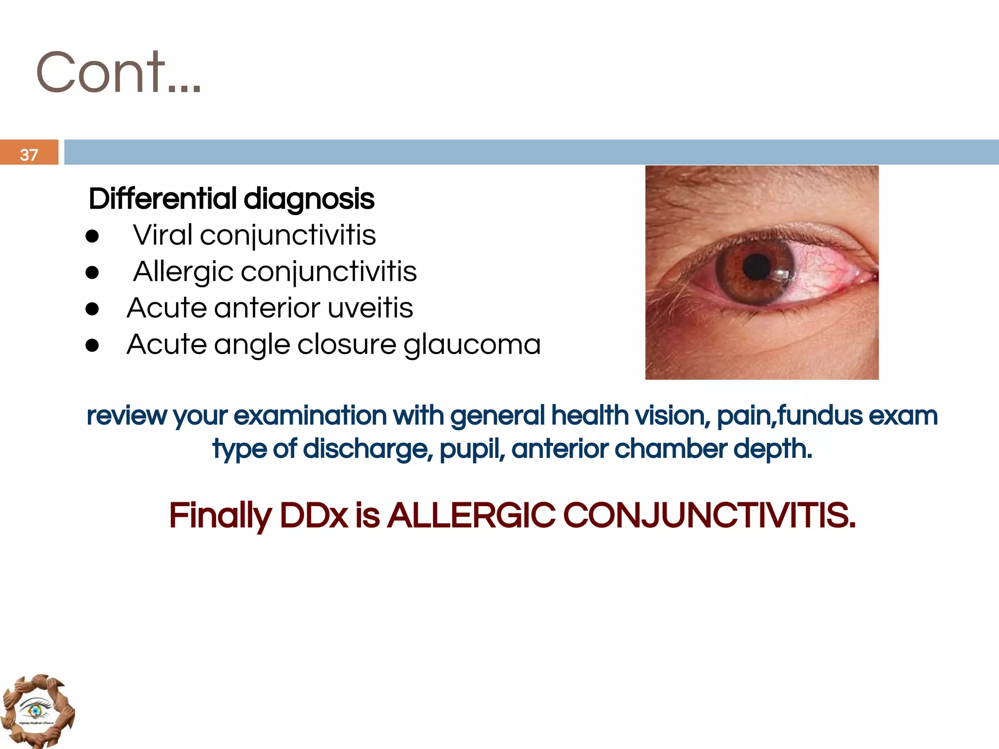Cont...
Differential diagnosis
● Viral conjunctivitis
● Allergic conjunctivitis
● Acute anterior uveitis
● Acute angle closure glaucoma
review your examination with general health vision, pain,fundus exam
type of discharge, pupil, anterior chamber depth.
Finally DDx is ALLERGIC CONJUNCTIVITIS.
37
 
