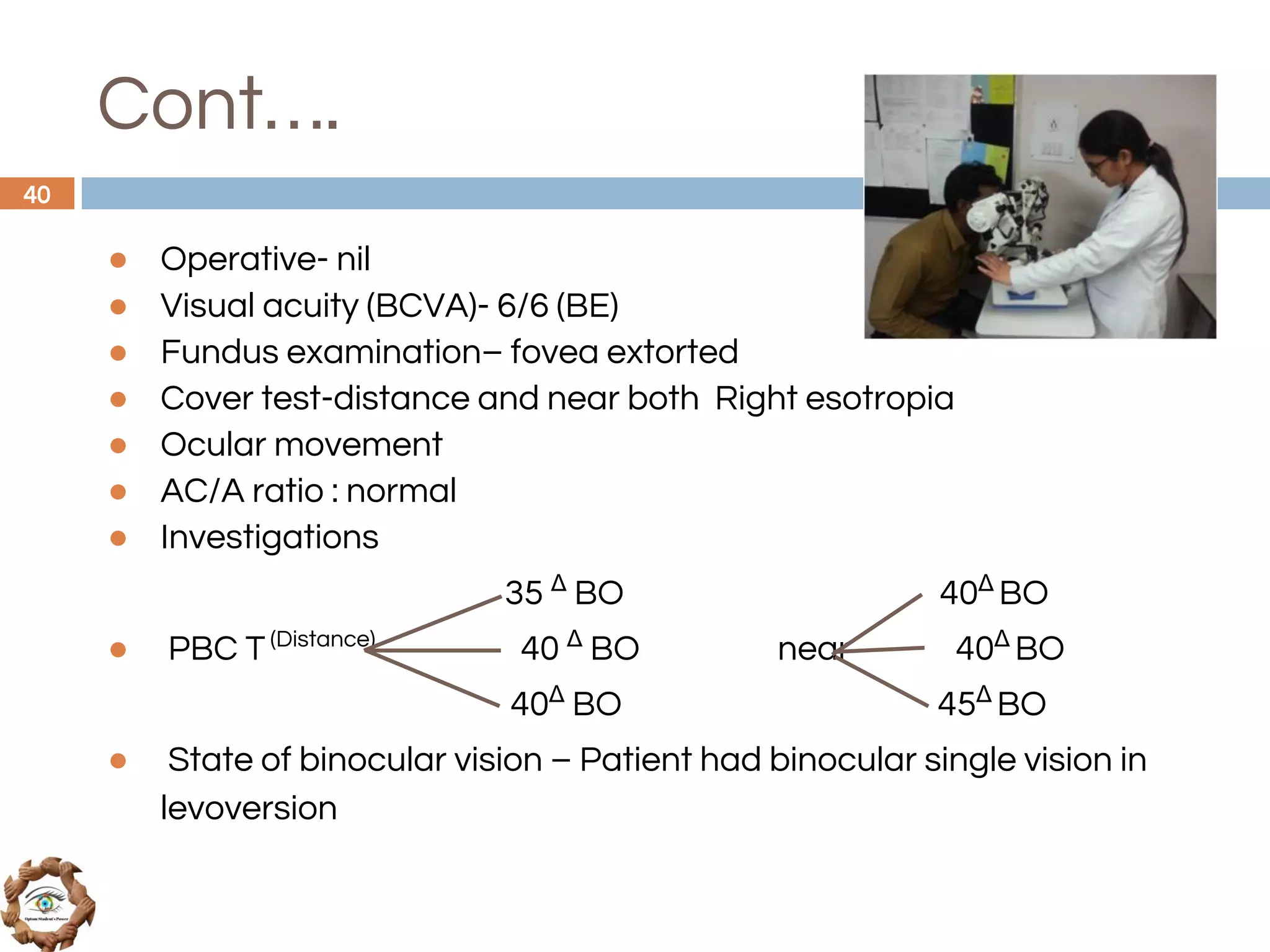Cont….
● Operative- nil
● Visual acuity (BCVA)- 6/6 (BE)
● Fundus examination– fovea extorted
● Cover test-distance and near both Right esotropia
● Ocular movement
● AC/A ratio : normal
● Investigations
35 Δ
BO 40Δ
BO
● PBC T(Distance)
40 Δ
BO near 40Δ
BO
40Δ
BO 45Δ
BO
● State of binocular vision – Patient had binocular single vision in
levoversion
40
 