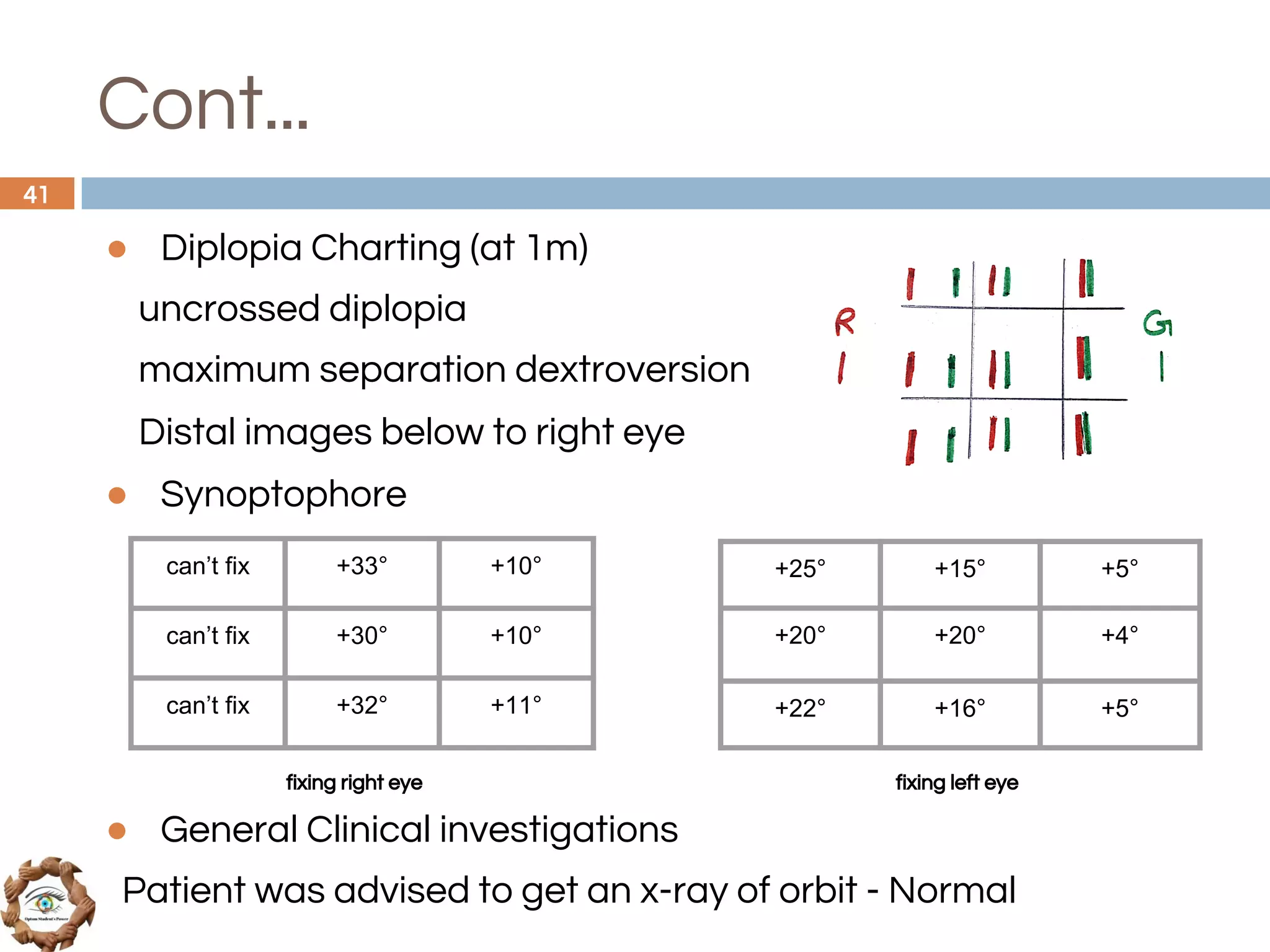 Cont...
● Diplopia Charting (at 1m)
uncrossed diplopia
maximum separation dextroversion
Distal images below to right eye
● Synoptophore
fixing right eye fixing left eye
● General Clinical investigations
Patient was advised to get an x-ray of orbit - Normal
41
can’t fix +33° +10°
can’t fix +30° +10°
can’t fix +32° +11°
+25° +15° +5°
+20° +20° +4°
+22° +16° +5°
 