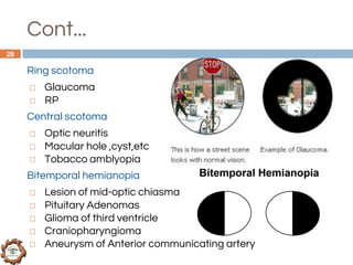 Protocol for differential diagnosis of common ocular diseases | PDF