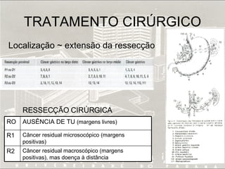 TRATAMENTO CIRÚRGICO Localização ~ extensão da ressecção RESSECÇÃO CIRÚRGICA Câncer residual macroscópico (margens positivas), mas doença à distância R2 Câncer residual microsocópico (margens positivas) R1 AUSÊNCIA DE TU  (margens livres) RO 