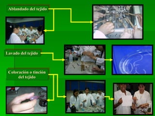 Ablandado del tejido Coloración o tinción del tejido Lavado del tejido