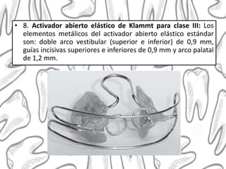 • 8. Activador abierto elástico de Klammt para clase III: Los
elementos metálicos del activador abierto elástico estándar
son: doble arco vestibular (superior e inferior) de 0,9 mm,
guías incisivas superiores e inferiores de 0,9 mm y arco palatal
de 1,2 mm.
 