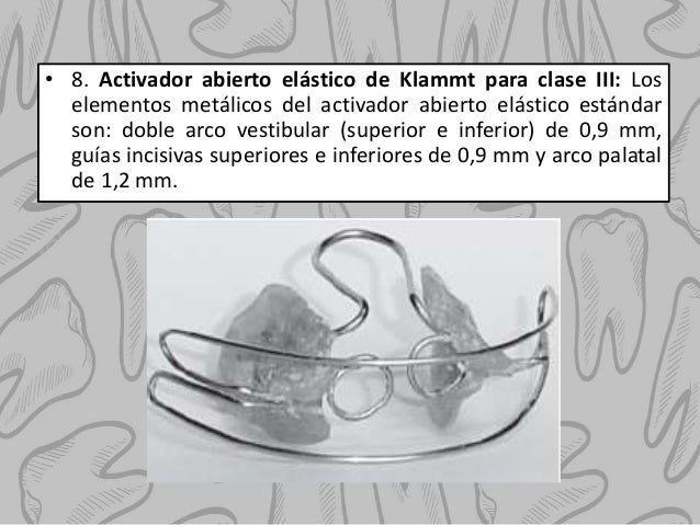 Activador Abierto Elastico De Klammt Para Clase Iii es.slideshare.net