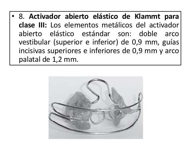 Activador Abierto Elastico De Klammt Para Clase Iii es.slideshare.net