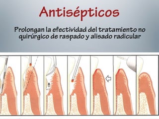 Protocolo en el Uso de Antibióticos en Odontología