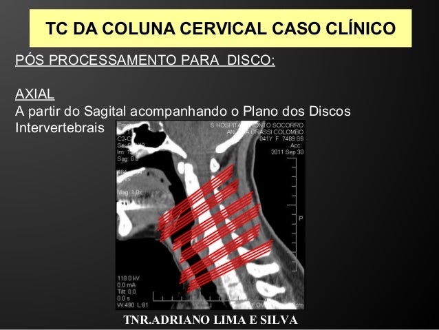 Exame da coluna cervical