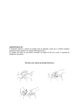 ADMINISTRAÇÃO
É importante observar o aspecto da insulina antes da aplicação, sendo que as insulinas regulares
apresentam aspecto límpido e as insulinas NPH aspecto turvo.
As injeções são feitas no sub-cutâneo formando um ângulo de 90º com a pele. A aspiração da
seringa não é necessária.
TÉCNICA DA APLICAÇÃO DE INSULINA
1 – Antissepsia da pele com álcool 2 – Faça uma prega no abdômen e
em seguida introduza a agulha
perpendicular à pele
3 – Retire a agulha e em seguida faça compressão do
local com algodão
 