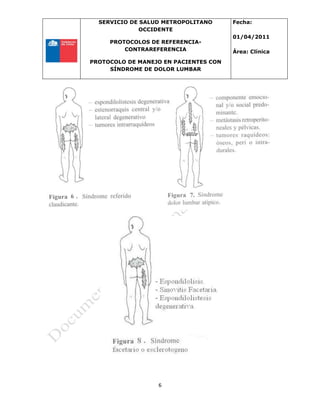 SERVICIO DE SALUD METROPOLITANO
OCCIDENTE
PROTOCOLOS DE REFERENCIA-
CONTRAREFERENCIA
PROTOCOLO DE MANEJO EN PACIENTES CON
SÍNDROME DE DOLOR LUMBAR
Fecha:
01/04/2011
Área: Clínica
6
 