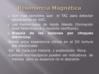  Son mas sensibles que el TAC para detectar 
alteraciones en SNC. 
 Las hemorragias de tejido blando (formación 
ósea heterotópica o myositis ossificans). 
 Biopsia de las lesiones por choques 
eléctricos: 
-Existe poca experiencia clínica en el DX tortura 
por electricidad. 
-DX se hace con historia y exploración física. 
-Cambios microscópicos pueden ser indicativos de 
trauma pero su ausencia no lo descarta. 
 
