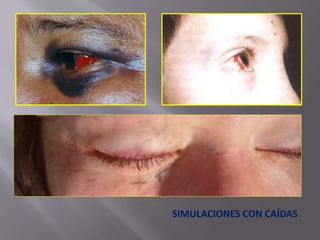 SIMULACIONES CON CAÍDAS 
 